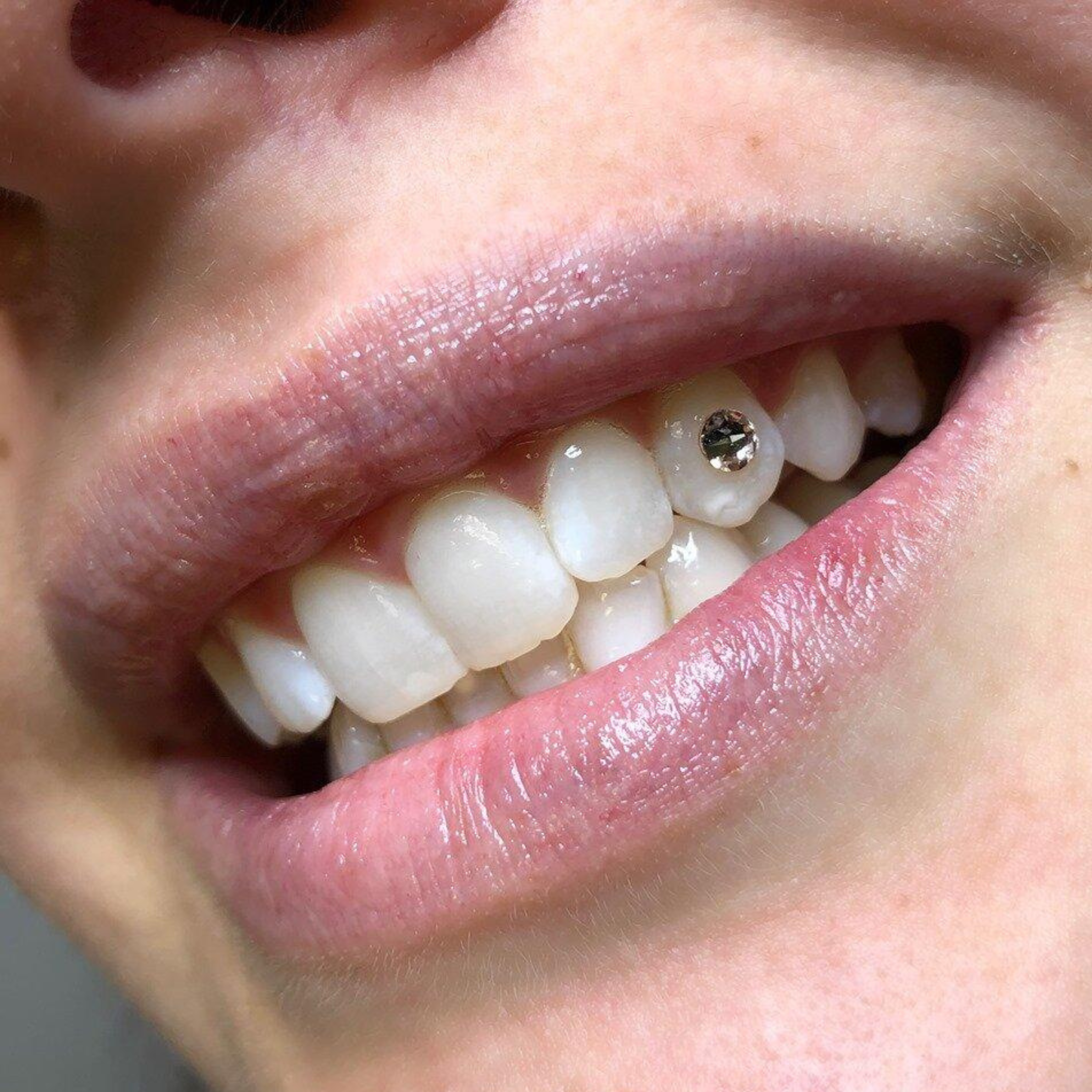 Styling visualization for 2. Tooth Gems & Crystals
