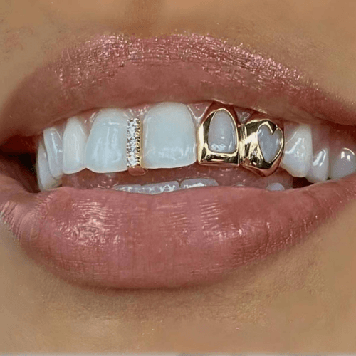 Teeth crystals and jewels shining on a patient smile
