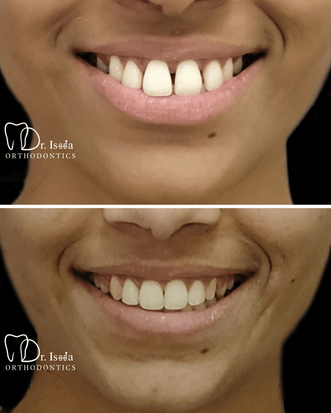 Smile transformation 7
