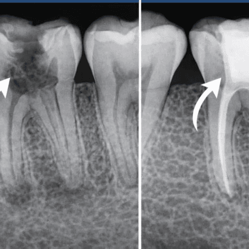 Perfect tooth recovery outcome visualization