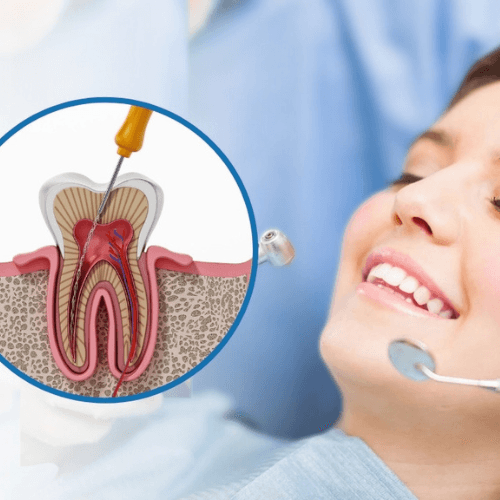 Doctor performing root canal treatment under local anesthesia