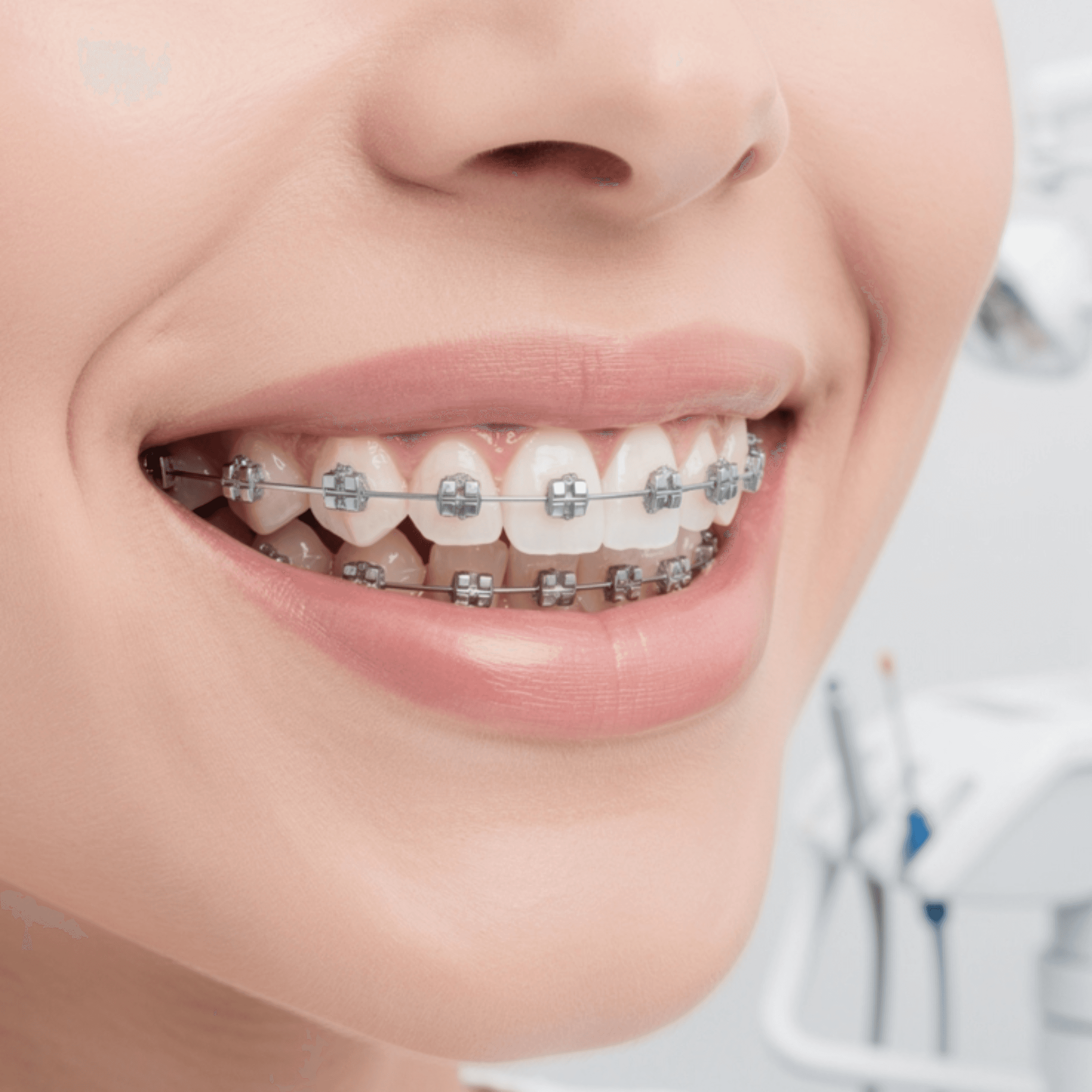 Orthodontic braces treatment visual