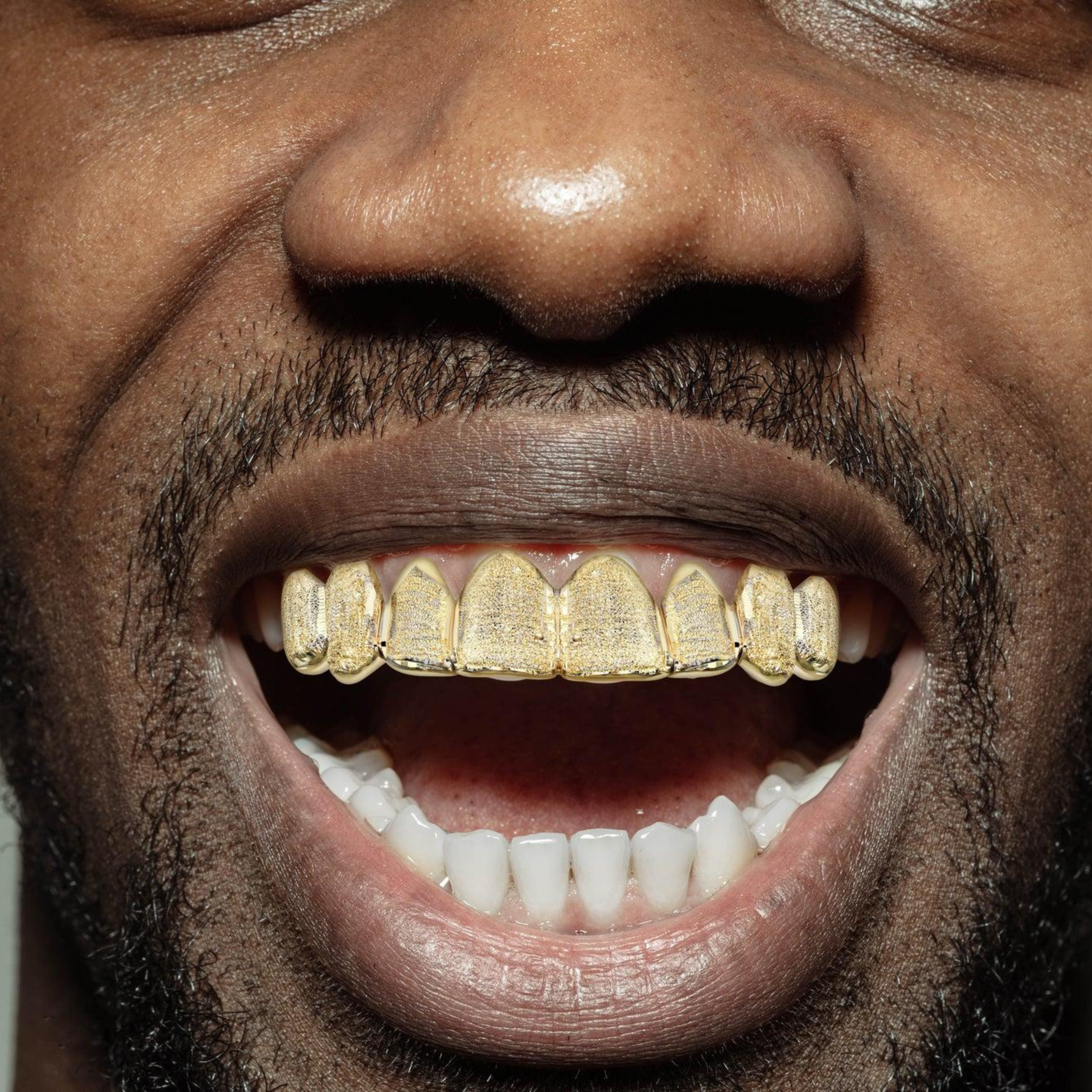 A patient displaying shiny decorative crystals on their teeth for a personalized look