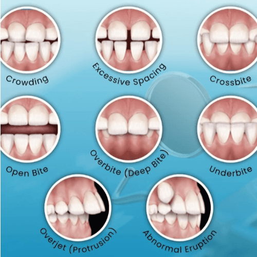 Perfect orthodontic smile transformation align results