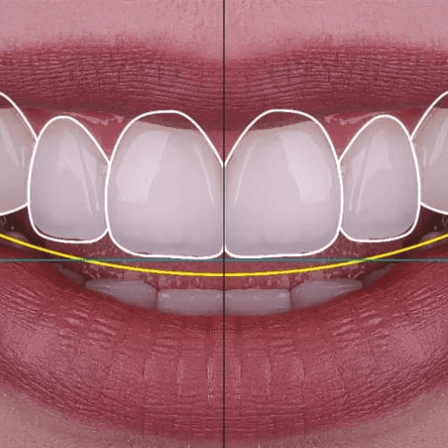 A dentist displaying preview of 3D aligner digital treatment plan